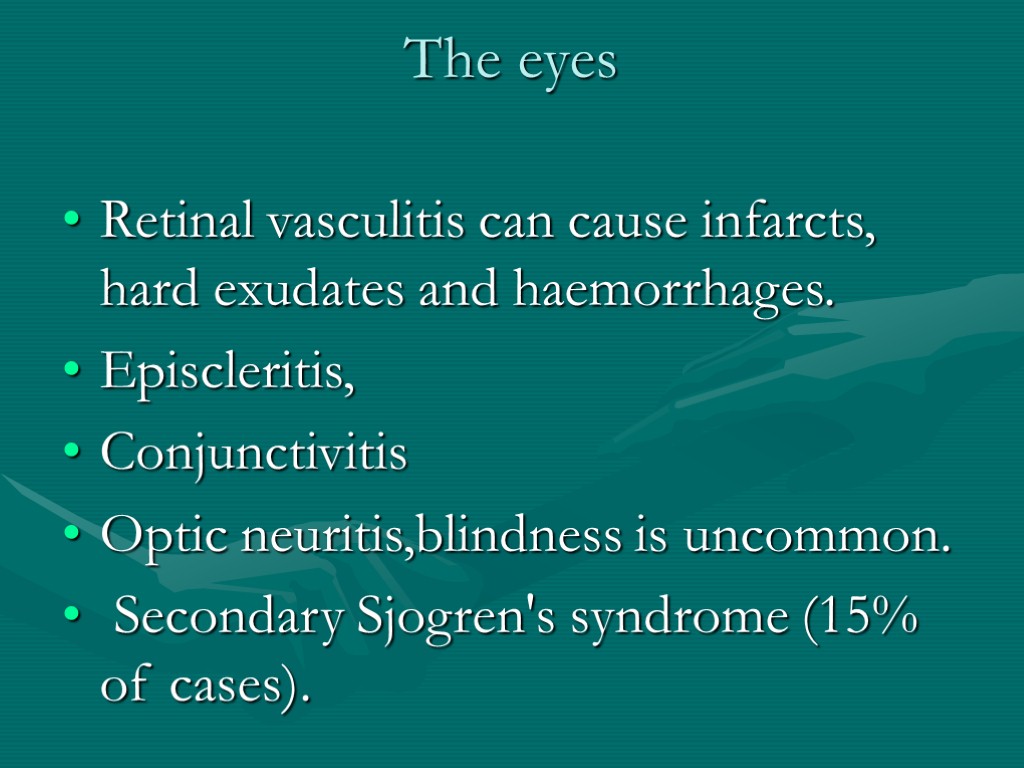 The eyes Retinal vasculitis can cause infarcts, hard exudates and haemorrhages. Episcleritis, Conjunctivitis Optic